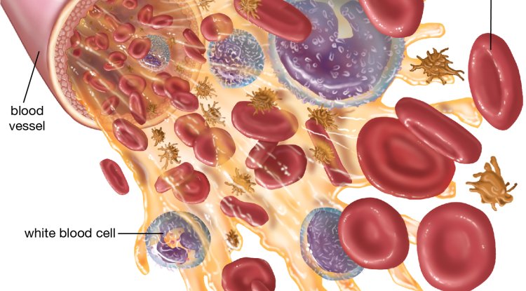 Blood Diseases: White and Red Blood Cells, Platelets and Plasma